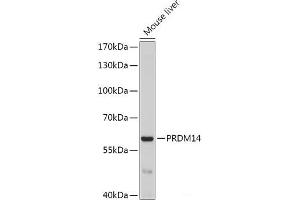 PRDM14 抗体