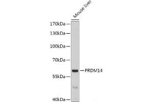 Western blot analysis of extracts of Mouse liver using PRDM14 Polyclonal Antibody at dilution of 1:1000. (PRDM14 抗体)