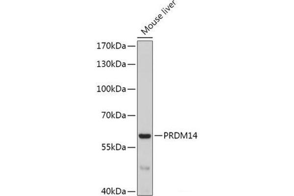 PRDM14 抗体