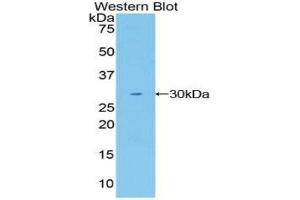 Western Blotting (WB) image for anti-Mindbomb E3 Ubiquitin Protein Ligase 1 (MIB1) (AA 769-1000) antibody (ABIN1859819)