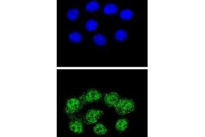 Confocal immunofluorescent analysis with Hela cells using MSH2 Antibody , followed by Alexa Fluor® 488-conjugated goat anti-rabbit lgG (green). (MSH2 抗体  (Middle Region))
