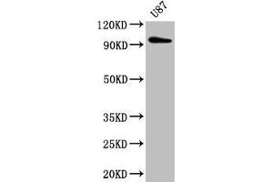 Western Blot Positive WB detected in: U87 whole cell lysate All lanes: TTLL6 antibody at 5 μg/mL Secondary Goat polyclonal to rabbit IgG at 1/50000 dilution Predicted band size: 97, 65 kDa Observed band size: 97 kDa (TTLL6 抗体  (AA 121-310))