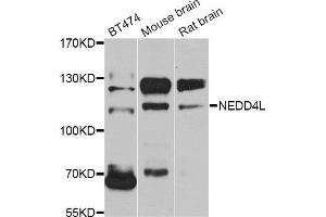 Western blot analysis of extracts of various cell lines, using NEDD4L antibody. (NEDD4-2 抗体)