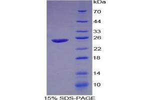 SDS-PAGE analysis of Guinea Pig Interferon alpha Protein. (IFNA 蛋白)