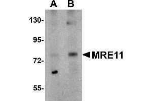 Western Blotting (WB) image for anti-MRE11 Meiotic Recombination 11 Homolog A (S. Cerevisiae) (MRE11A) (N-Term) antibody (ABIN1031460)