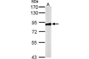 Western Blotting (WB) image for anti-Vacuolar Protein Sorting 35 (VPS35) (C-Term) antibody (ABIN2856562)
