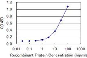 Detection limit for recombinant GST tagged LRAT is 0. (LRAT 抗体  (AA 33-132))