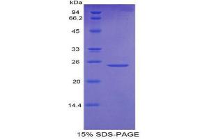 SDS-PAGE (SDS) image for Osteoclast Stimulating Factor 1 (OSTF1) (AA 10-215) protein (His tag) (ABIN1879313)