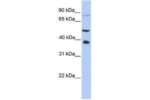 METTL2B antibody used at 1 ug/ml to detect target protein. (METTL2B 抗体  (N-Term))