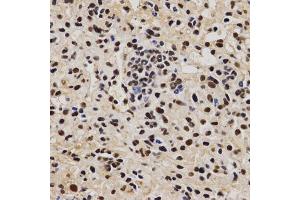 Immunohistochemistry of paraffin-embedded mouse liver fibrosis using PELP1 antibody (ABIN6292223) at dilution of 1:200 (40x lens). (PELP1 抗体)
