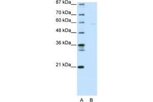 Western Blotting (WB) image for anti-SWI/SNF Related, Matrix Associated, Actin Dependent Regulator of Chromatin, Subfamily D, Member 3 (SMARCD3) antibody (ABIN2461185) (SMARCD3 抗体)