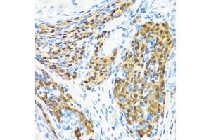Immunohistochemistry of paraffin-embedded rat ovary using KMT2E antibody (ABIN6131786, ABIN6142983, ABIN6142984 and ABIN6221745) at dilution of 1:200 (40x lens). (MLL5/KMT2E 抗体  (AA 200-500))