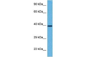 Host:  Rabbit  Target Name:  ST3GAL4  Sample Tissue:  Human 786-0 Whole Cell  Antibody Dilution:  1ug/ml (ST3GAL4 抗体  (Middle Region))
