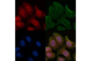 ABIN6255395 and ABIN6266473 staining Hela cells by IF/ICC.