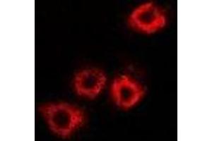 Immunofluorescent analysis of HADHB staining in A549 cells. (HADHB 抗体)