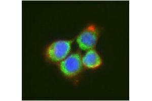 Immunofluorescence (IF) image for anti-DEAD (Asp-Glu-Ala-Asp) Box Polypeptide 6 (DDX6) antibody (ABIN2664929) (DDX6 抗体)
