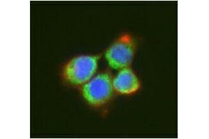 Immunofluorescence (IF) image for anti-DEAD (Asp-Glu-Ala-Asp) Box Polypeptide 6 (DDX6) antibody (ABIN2664929) (DDX6 抗体)