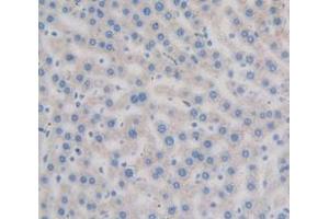 Used in DAB staining on fromalin fixed paraffin- embedded Kidney tissue (Axin 抗体  (AA 618-827))