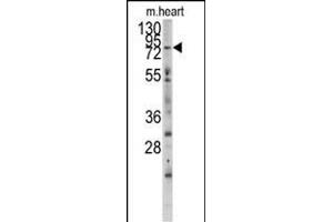 Western blot analysis of anti-MYLK3 Antibody (N-term) (ABIN392494 and ABIN2837985) in mouse heart tissue lysates (35 μg/lane). (MYLK3 抗体  (N-Term))