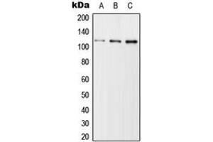 Western blot analysis of USP11 expression in Jurkat (A), SP2/0 (B), H9C2 (C) whole cell lysates. (USP11 抗体  (Center))