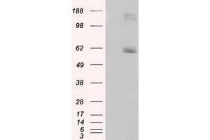 HEK293T cells were transfected with the pCMV6-ENTRY control (Left lane) or pCMV6-ENTRY LIPG (Right lane) cDNA for 48 hrs and lysed. (LIPG 抗体)