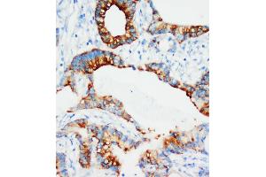 Immunohistochemistry (IHC) image for anti-Insulin-Like Growth Factor Binding Protein 3 (IGFBP3) (AA 182-198), (Middle Region) antibody (ABIN3044421)