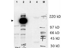 Image no. 1 for anti-Castor Zinc Finger 1 (CASZ1) (N-Term) antibody (ABIN401359) (CASZ1 抗体  (N-Term))