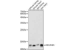 Western blot analysis of extracts of various cell lines, using NDUF antibody (ABIN7268817) at 1:1000 dilution.