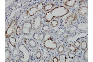 Immunoperoxidase of monoclonal antibody to DLD on formalin-fixed paraffin-embedded human kidney. (DLD 抗体  (AA 1-509))