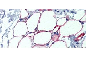 Immunohistochemistry (IHC) image for anti-Nuclear Factor I/C (CCAAT-Binding Transcription Factor) (NFIC) (Middle Region) antibody (ABIN2792686)