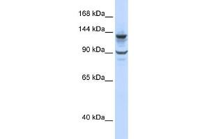 WB Suggested Anti-PGBD1 Antibody Titration:  0. (PGBD1 抗体  (N-Term))