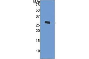 WB of Protein Standard: different control antibodies against Highly purified E. (ODC1 ELISA 试剂盒)