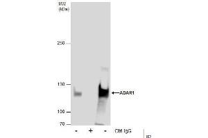 IP Image Immunoprecipitation of ADAR1 protein from 293T whole cell extracts using 5 μg of ADAR1 antibody [N3C1], Internal, Western blot analysis was performed using ADAR1 antibody [N3C1], Internal, EasyBlot anti-Rabbit IgG  was used as a secondary reagent.