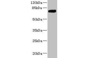 Western blot All lanes: KLHL13 antibody at 5. (KLHL13 抗体  (AA 1-260))