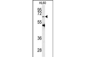 Western blot analysis of anti-PRMT5 Antibody (C-term ) (ABIN387841 and ABIN2843949) in HL60 cell line lysates (35 μg/lane). (PRMT5 抗体  (C-Term))