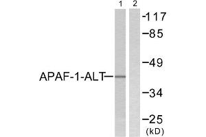 Western blot analysis of extracts from COLO205, using APAF-1-ALT antibody (ABIN5976347).