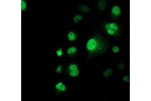 Anti-TP53 mouse monoclonal antibody (ABIN2454485) immunofluorescent staining of COS7 cells transiently transfected by pCMV6-ENTRY TP53 (RC200003). (p53 抗体)