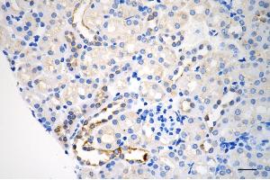 Immunohistochemistry was performed on paraffin-embedded mouse kidney using arg2 antibody (ABIN7797644), 1:200). (Recombinant ARG2 抗体)