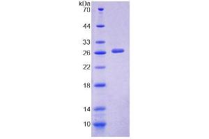 SDS-PAGE analysis of Mouse PTPN3 Protein. (PTPN3 蛋白)