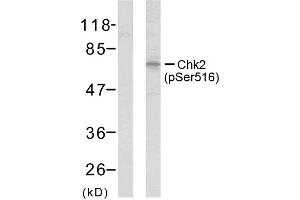 Western blot analysis of extracts from HeLa cells using Chk2 (phospho-Ser516) antibody (E011147). (CHEK2 抗体  (pSer516))