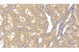 Detection of MMP8 in Human Kidney Tissue using Monoclonal Antibody to Matrix Metalloproteinase 8 (MMP8) (MMP8 抗体  (AA 101-467))