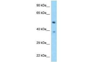 WB Suggested Anti-TSEN2 Antibody Titration: 1. (TSEN2 抗体  (C-Term))