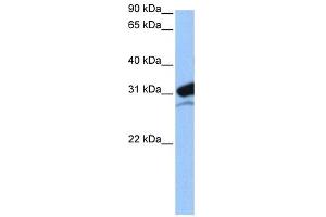 MRPL24 antibody used at 0. (MRPL24 抗体  (N-Term))