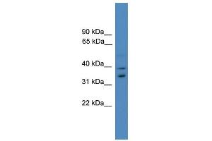 WB Suggested Anti-UFD1L Antibody Titration: 0. (UFD1L 抗体  (Middle Region))