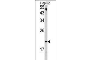 Western blot analysis of VHL antibody in HepG2 cell line lysates (35ug/lane) (VHL 抗体  (C-Term))