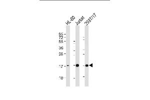 All lanes : Anti-SUMO3 Antibody at 1:2000 dilution Lane 1: HL-60 whole cell lysate Lane 2: Jurkat whole cell lysate Lane 3: 293T/17 whole cell lysate Lysates/proteins at 20 μg per lane. (SUMO3 抗体)