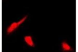 Immunofluorescent analysis of PSMB4 staining in U2OS cells.