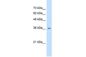 WB Suggested Anti-NUDT9 Antibody Titration:  0. (NUDT9 抗体  (N-Term))