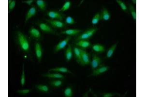 Immunofluorescence (IF) image for anti-Aldehyde Dehydrogenase 7 Family, Member A1 (ALDH7A1) (AA 386-515) antibody (ABIN7143836)