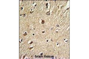 Immunohistochemistry (Paraffin-embedded Sections) (IHC (p)) image for anti-Biglycan (BGN) (AA 148-176) antibody (ABIN390701)